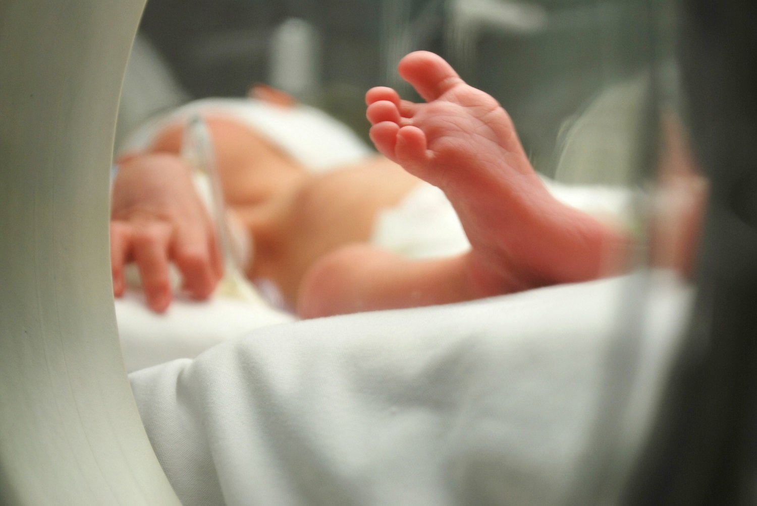 UCIN — área neonatal